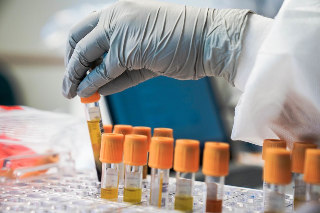 A hand wearing a medical rubber glove puts a vial of fluid in a specimen holder.