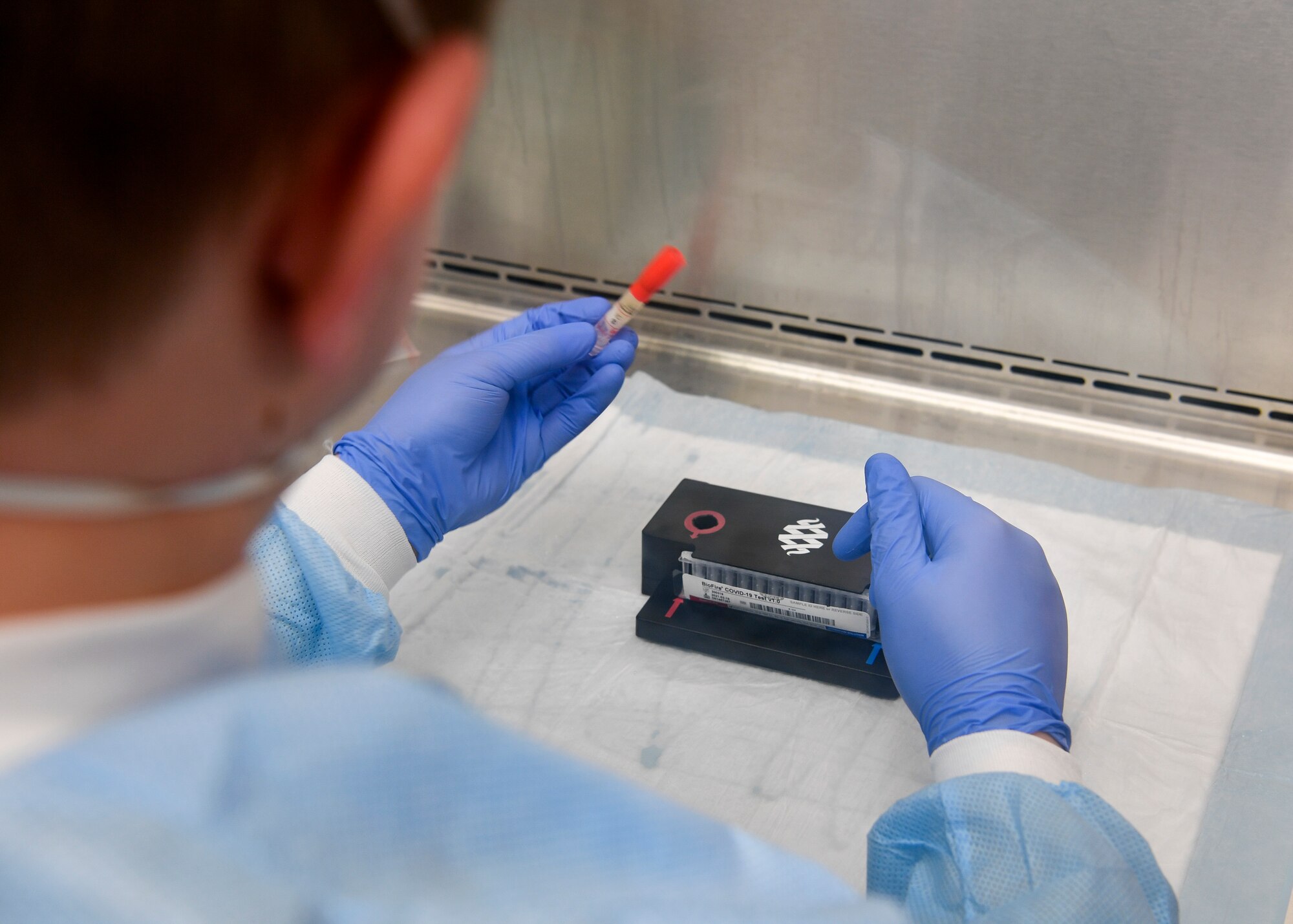 Photo of a medical technician conducting a chain reaction test.