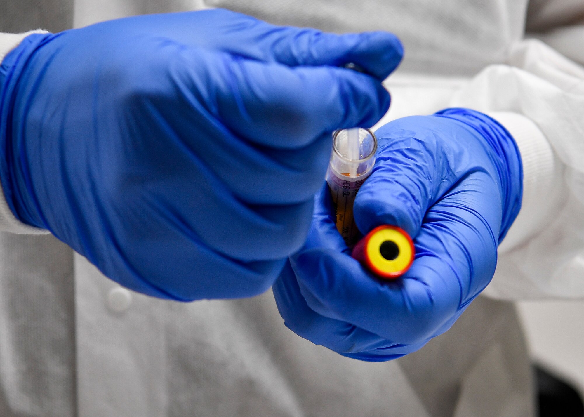 A close up photo of a medical technicians hands and a serum test.