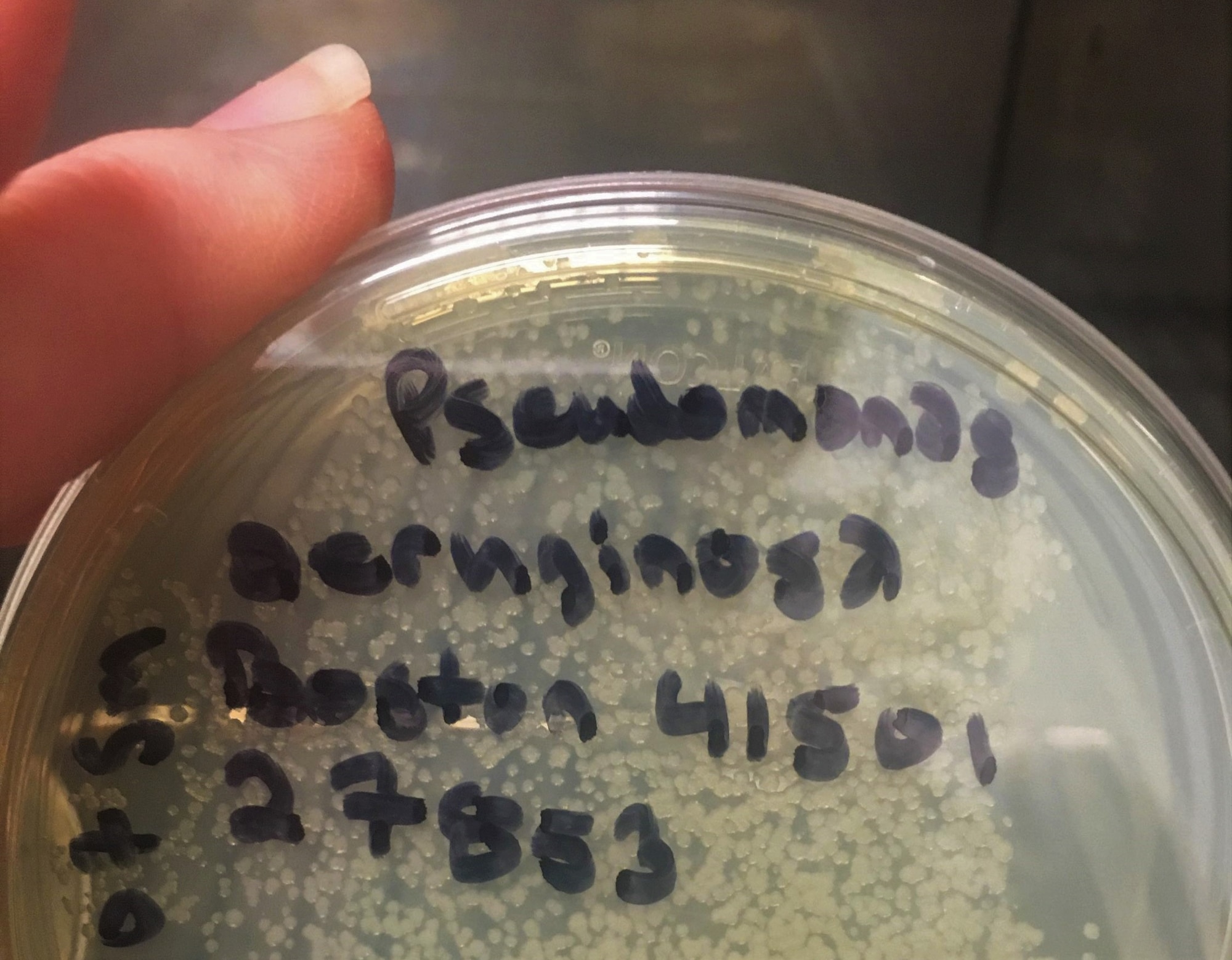 An Air Force Civil Engineer Center Lab team member looks at a sample of the Pseudomonas aeruginosa bacteria.