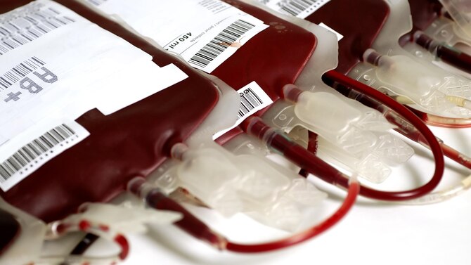 Bagged fresh whole blood
