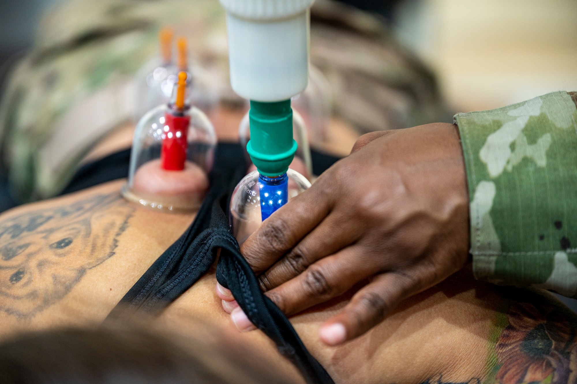 Cupping Therapy is applied to Airman's back