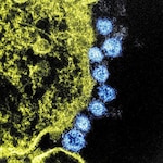 The Centers for Disease Control and Prevention has said that the coronavirus, named 2019-nCoV, is similar to the Middle East Respiratory Syndrome coronavirus in that it is spread from animals to people. The MERS virus particles are in blue, surrounding an infected cell. The undated image was taken at Fort Detrick, Maryland.