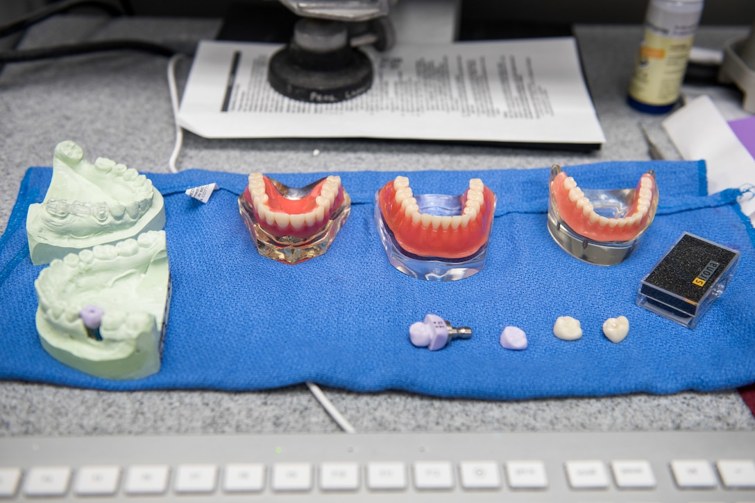 Dental replicas are display on a desk.