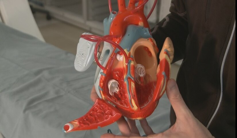 Walter Reed National Military Medical Center cardiologist, Navy Cmdr. (Dr.) Matthew Needleman, holds a model heart.