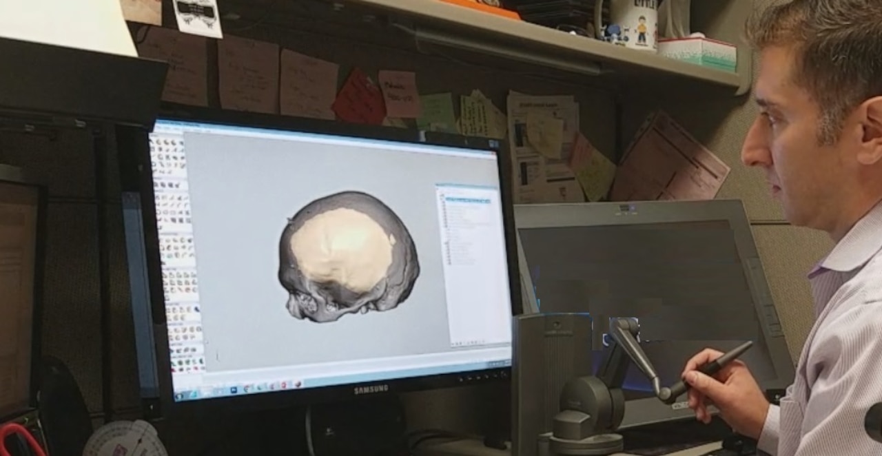 Peter Liacouras, Ph.D., demonstrates computer software that allows him to manipulate and cut a custom cranial plate design