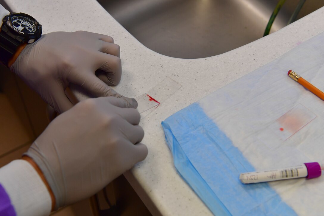 The hands of an Airman preparing a blood sample on a glass microscope slide.