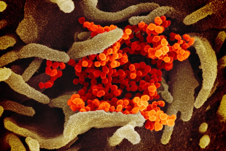 microscopic image of the visrus that causes COVID-19