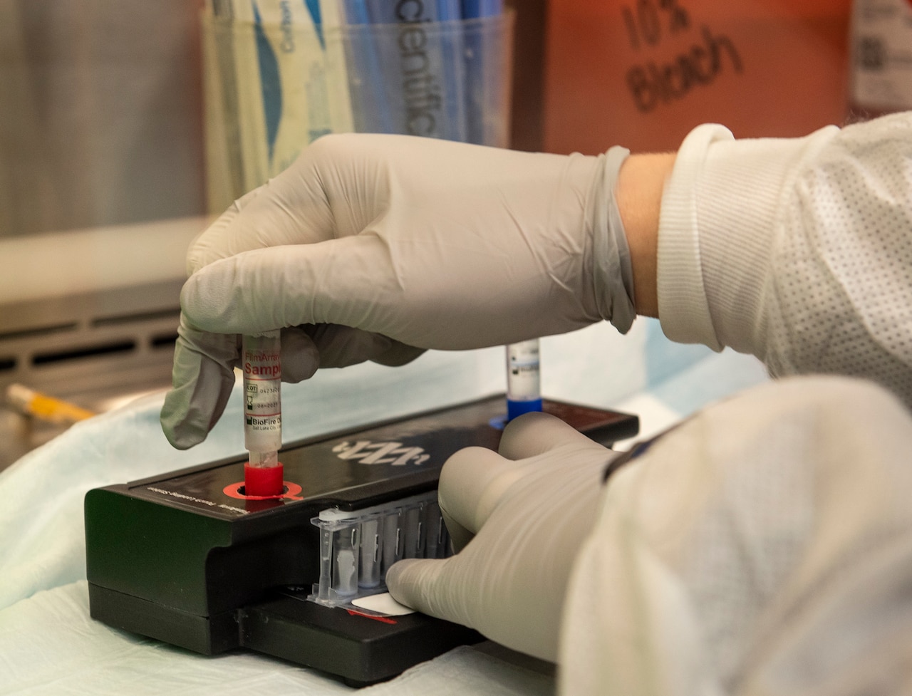 A lab technician handles a sample before COVID-19 testing.