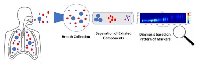 This schematic illustration shows how a disease is identified by the pattern of compounds detected in exhaled breath. Gas chromatography is an analytical technique that separates the chemical constituents of an air sample into components, with the retention time (the amount of time it takes for a given compound to pass through the chromatography column) being an identifying characteristic of each compound. (Courtesy illustration)