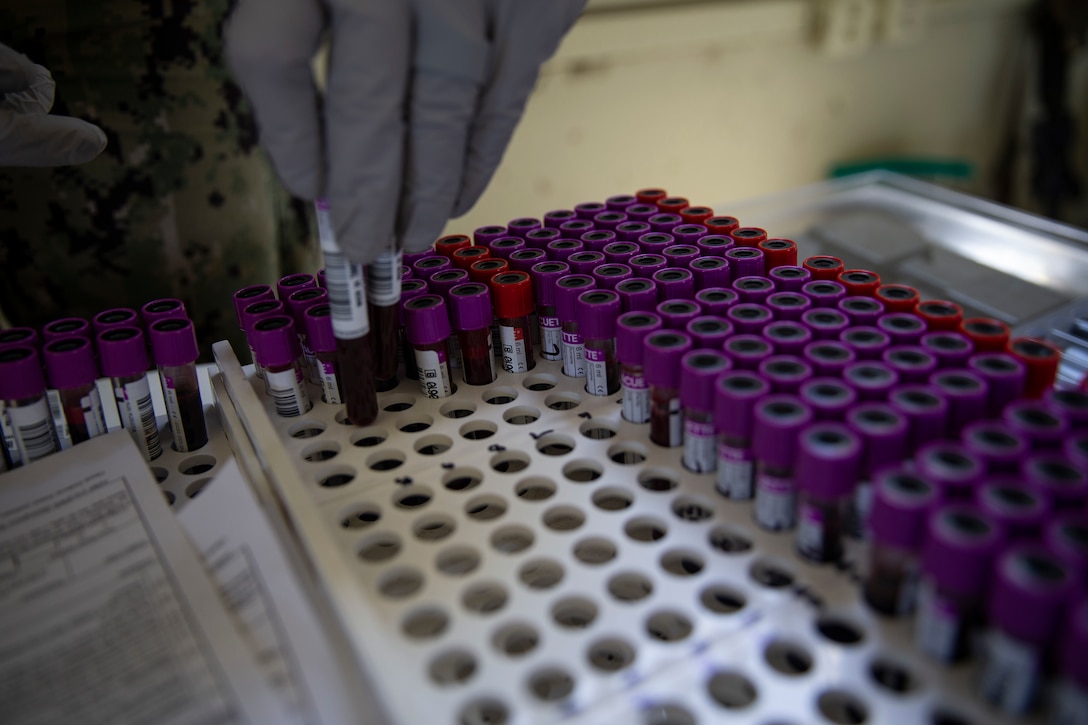 Vials of blood in a tray.