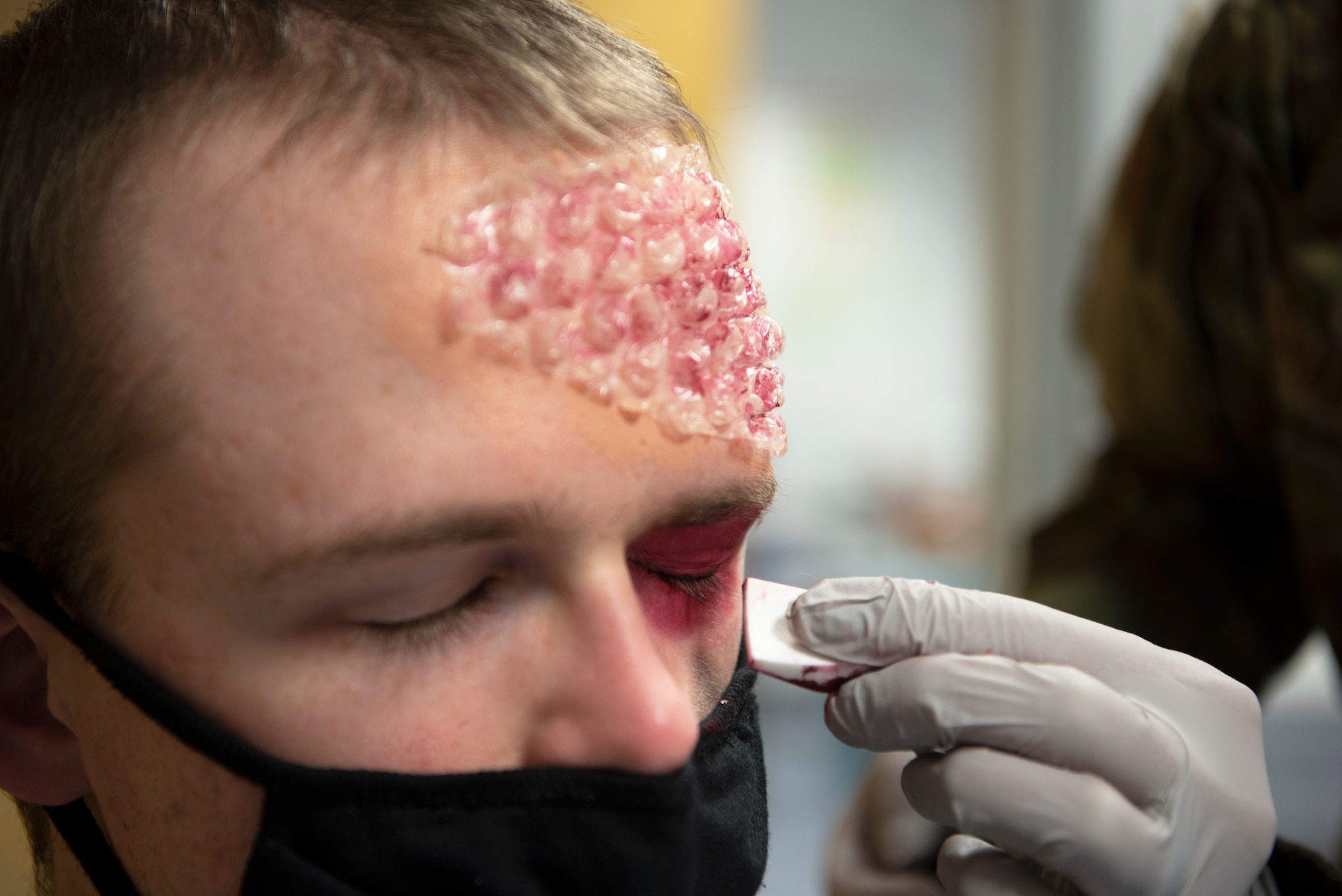 U.S. Air Force Senior Airman James Levesque, 52nd Maintenance Squadron aerospace propulsion journeyman, gets moulage applied to his face during a base readiness exercise at Spangdahlem Air Base, Germany, Nov. 18, 2020. The moulage simulated a chemical burn and was intended to provide practice for the medical team on how to deal with these injuries. (U.S. Air Force photo by Senior Airman Jovante Johnson)