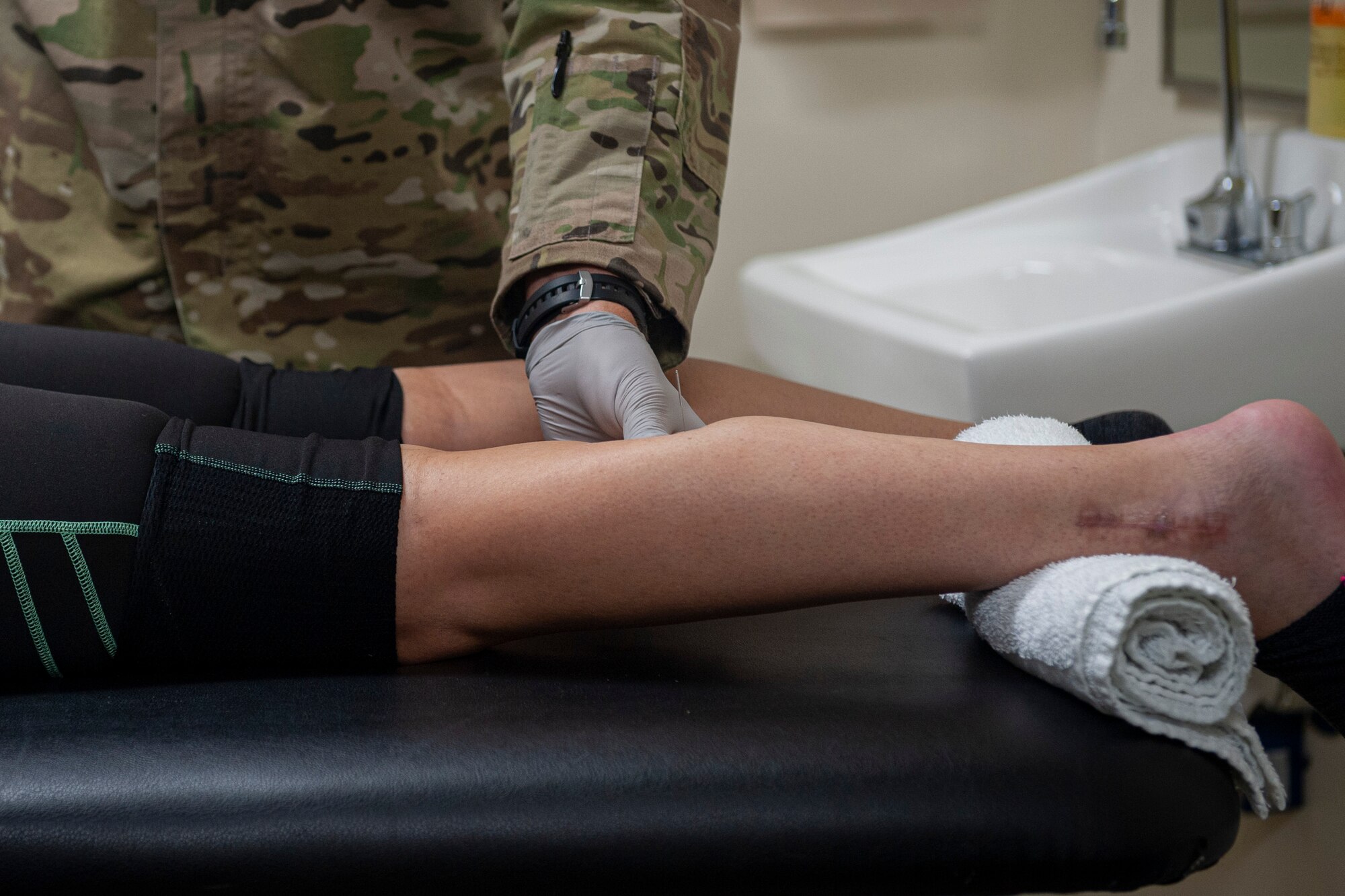 Photo of an Airman performing dry needling