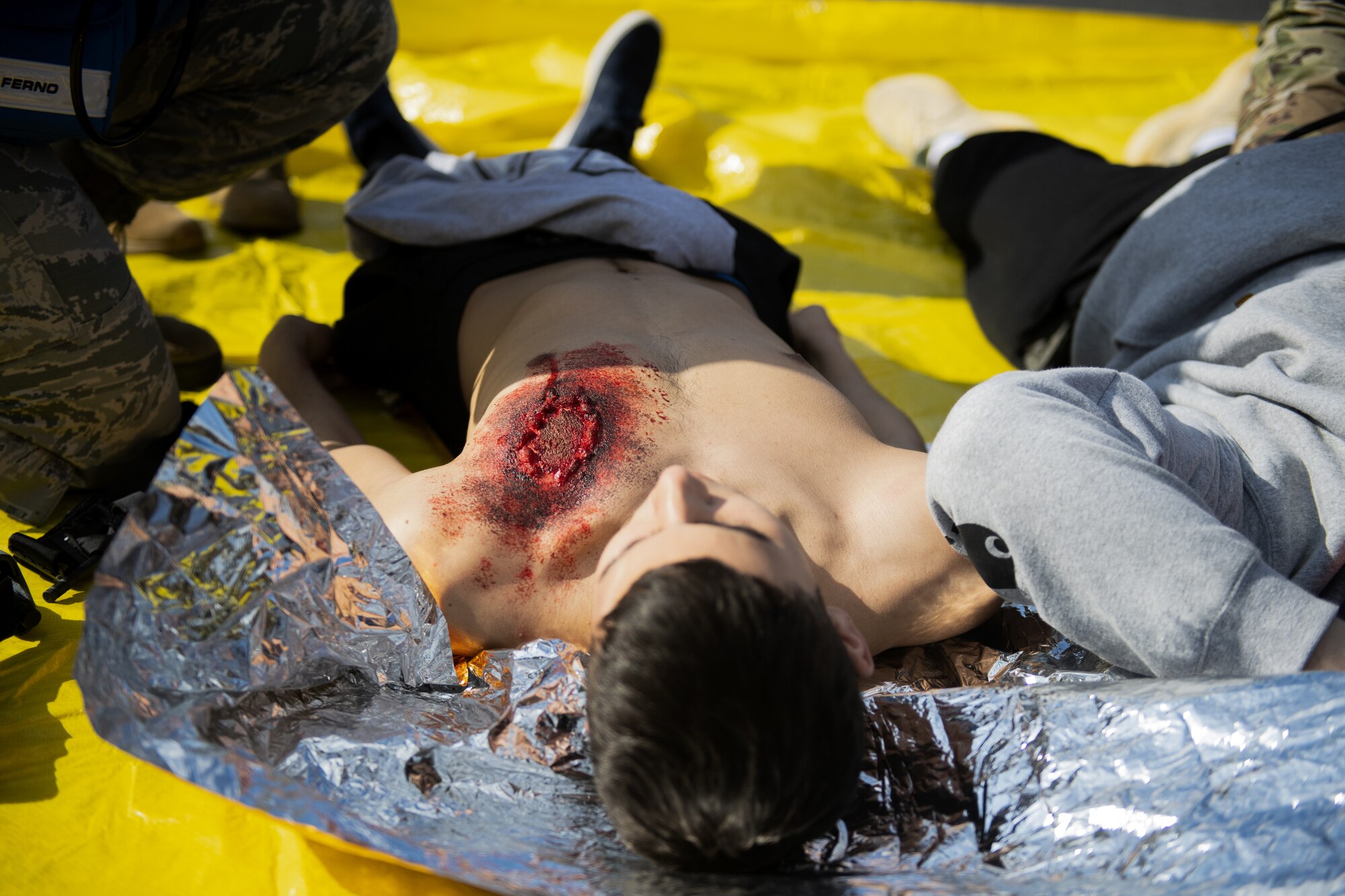 A volunteer for the 52nd Medical Group exercise Ready EAGLE lies on a tarp awaiting simulated medical attention at Spangdahlem Air Base, Germany, March 26, 2021. Exercise Ready EAGLE is a Headquarters Air Force initiative championed by the AF Surgeon General since 2019 to reinvigorate installation medical response programs. (U.S. Air Force photo by Senior Airman Ali Stewart)