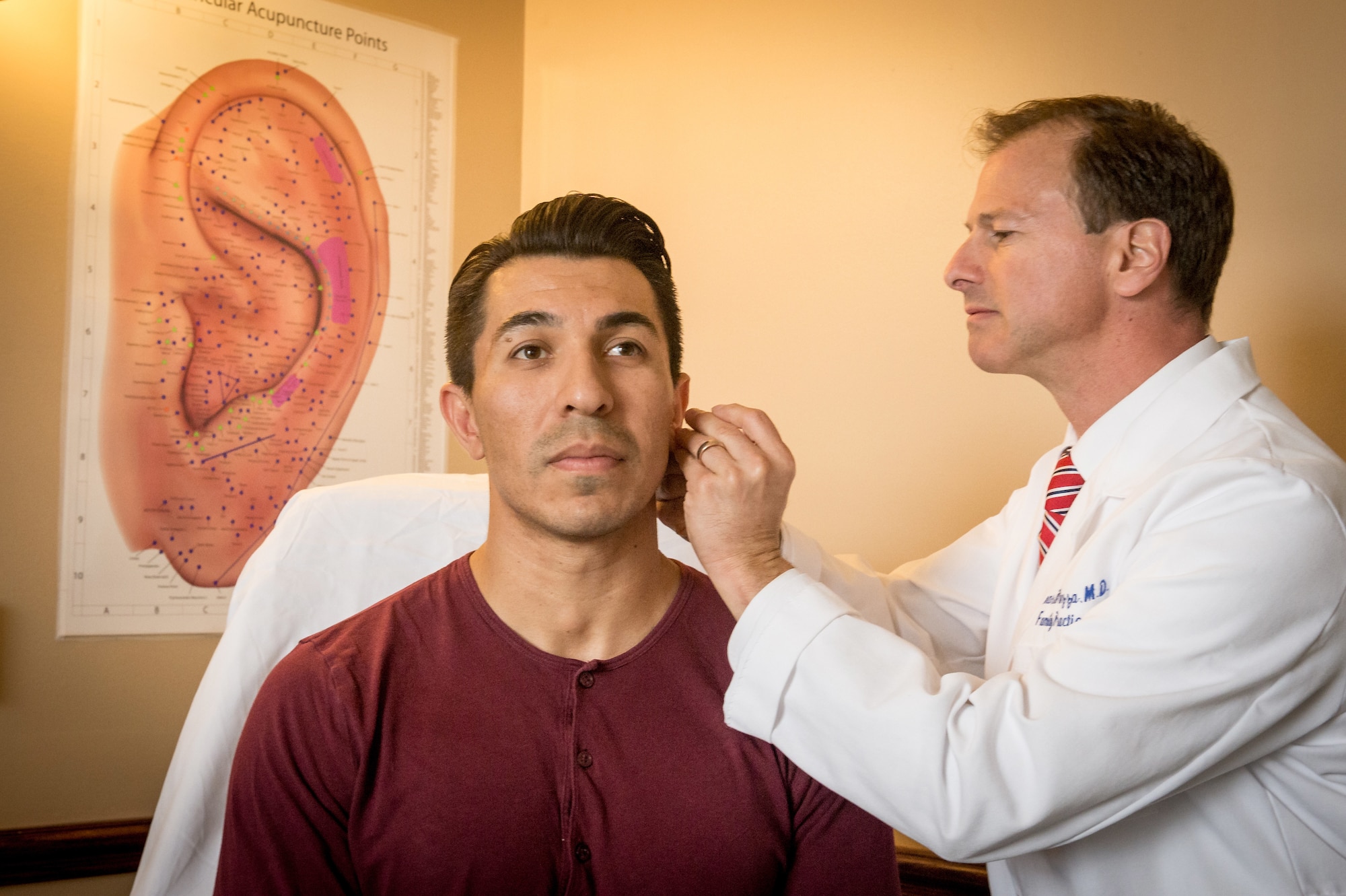 Battlefield Acupuncture treatment