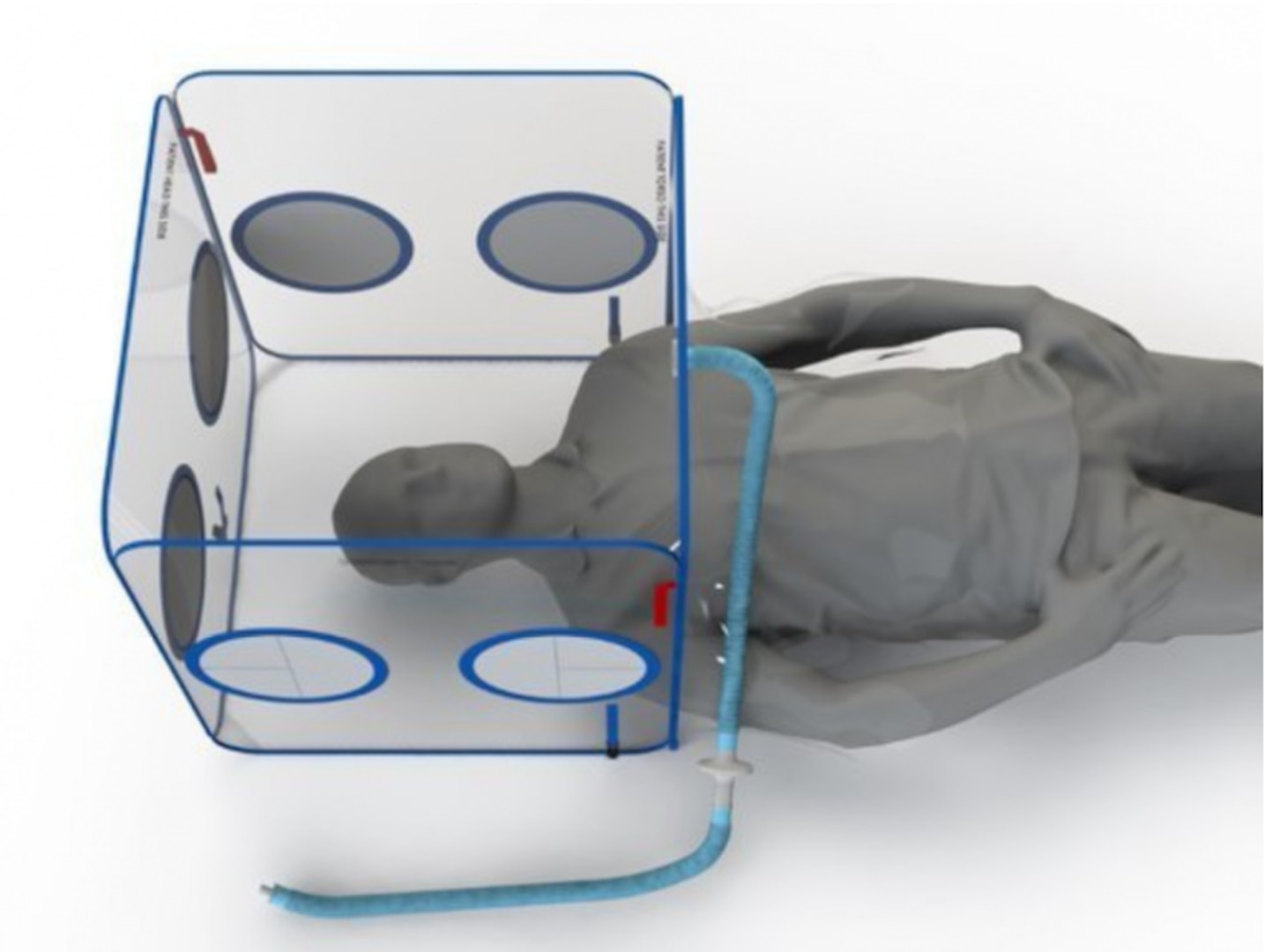 The STAT Enclosure allows medical staff to safely treat and transport critically ill patients while significantly reducing droplets. Photo courtesy of Olifant Medical.