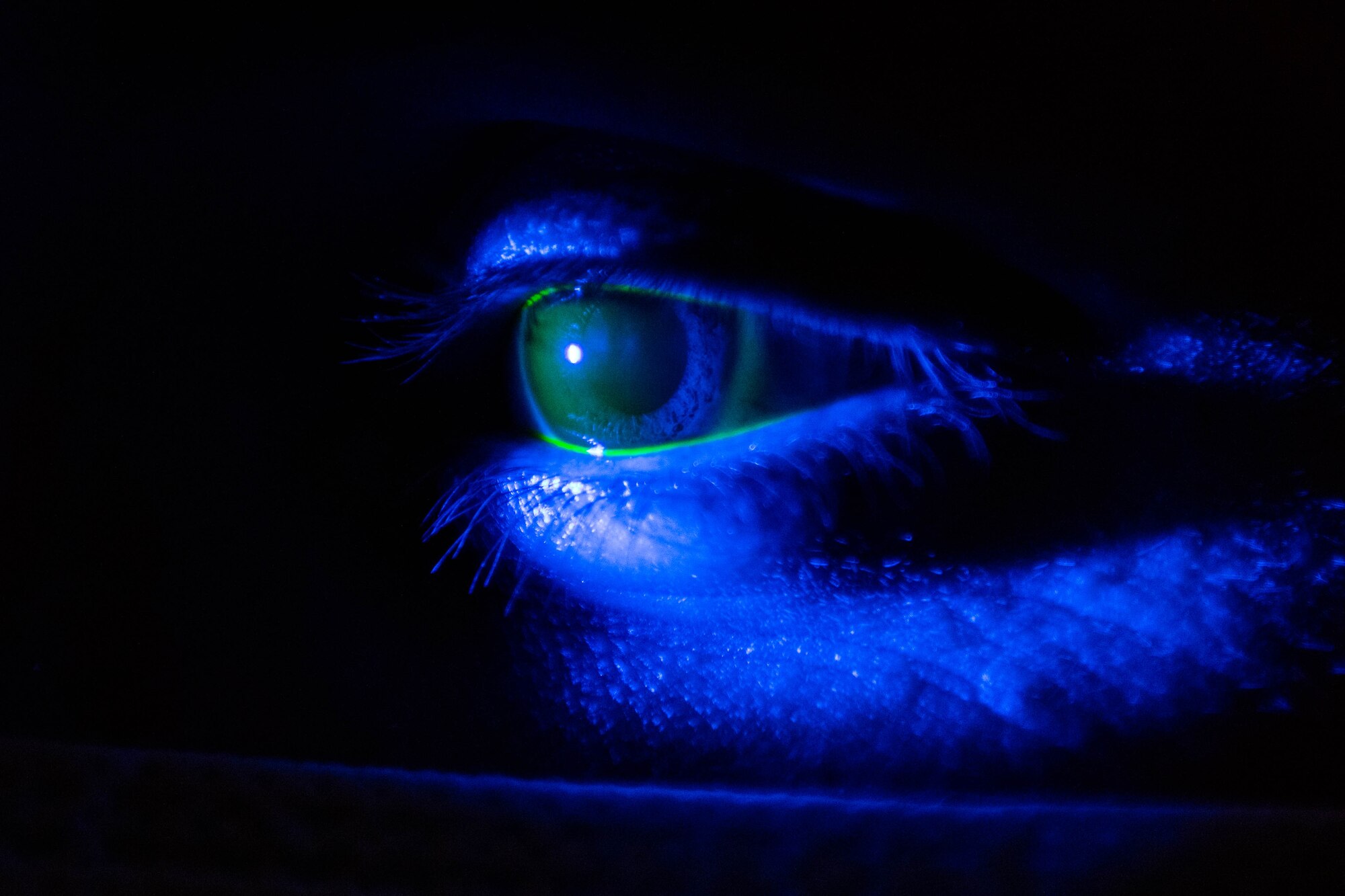 U.S. Air Force Staff Sgt. Dalton Aric, 31st Civil Engineer Squadron firefighter, receives a fluorescein evaluation at Aviano Air Base, Italy, Dec. 2, 2021. Fluorescein is used to assist in the detection of debris and corneal abrasions and the blue light helps identify and highlight the tears. (U.S. Air Force photo by Senior Airman Brooke Moeder)