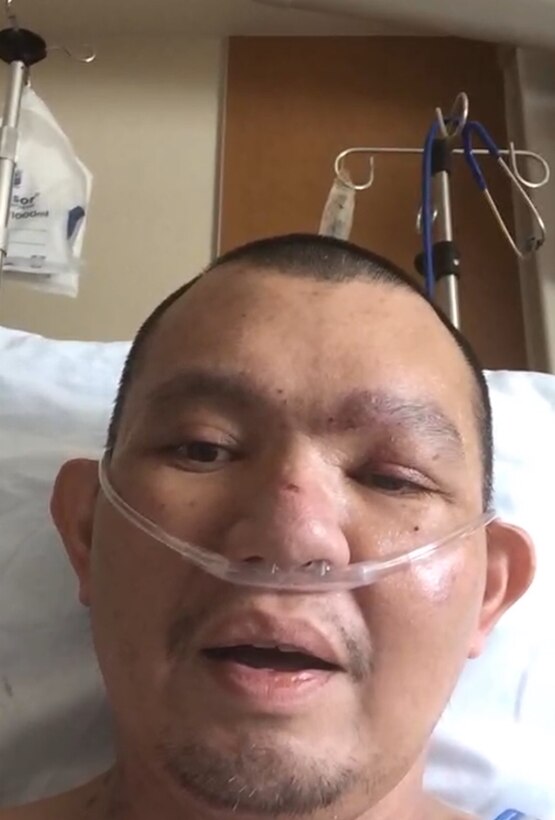 Tech Sgt. Lloyd Tumbaga was hospitalized with COVID-19 for 17 days in July 2020.
