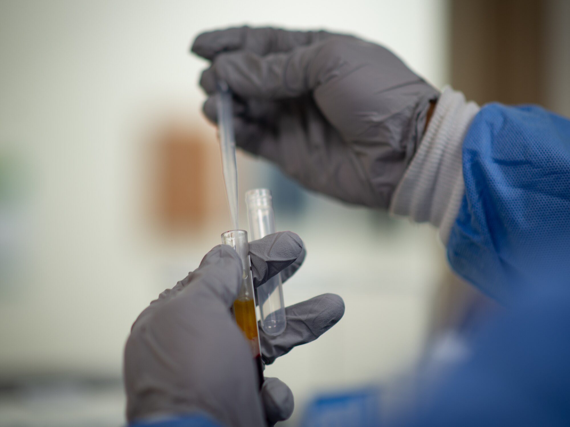 Senior Airman Jules Bea, 36th Medical Operations Squadron laboratory technician, holds a serum sample in the laboratory at Andersen Air Force Base, Guam, Jan. 28, 2021. During the last week of January, members of Andersen AFB recognized all the hard work done by Airmen in the Biomedical Science Corps in honor of the 56th Annual Biomedical Science Corps Appreciation Week. (U.S. Air Force photo by Airman Kaitlyn Preston)