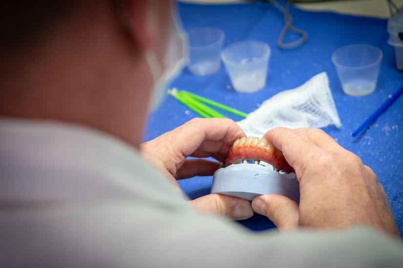 A man lines up a dental prosthesis with a mold of the jaw.