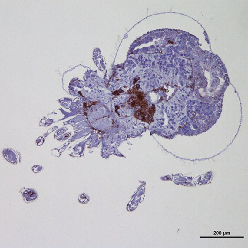 Immunohistochemistry section of a chigger mite infected by Scrub Typhus
