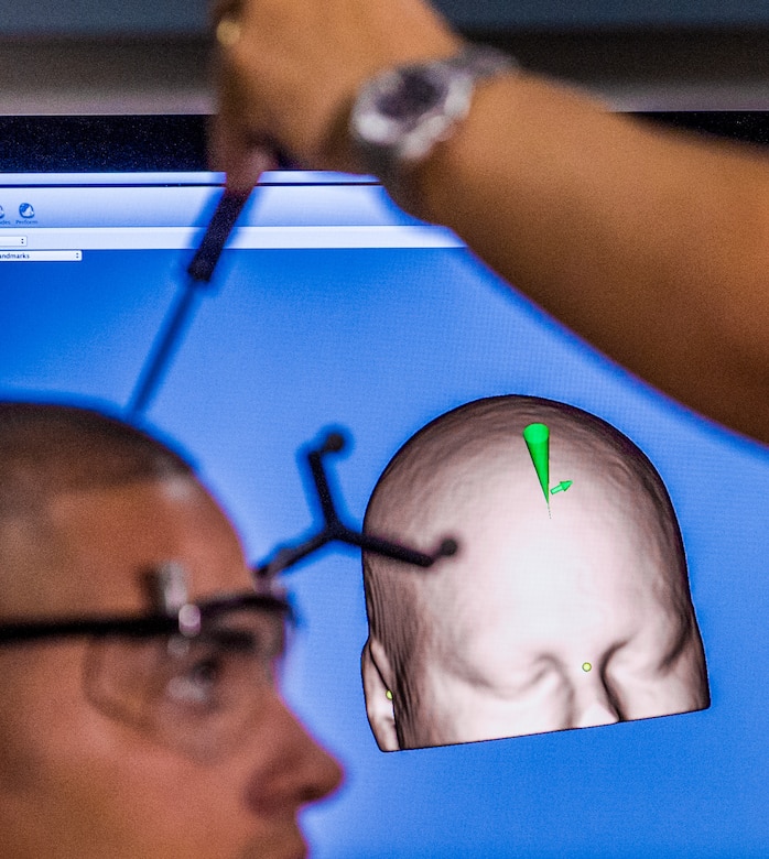Non-Invasive Brain Stimulation (NIBS) Team calibrate the Brainsight Neuronavigation System