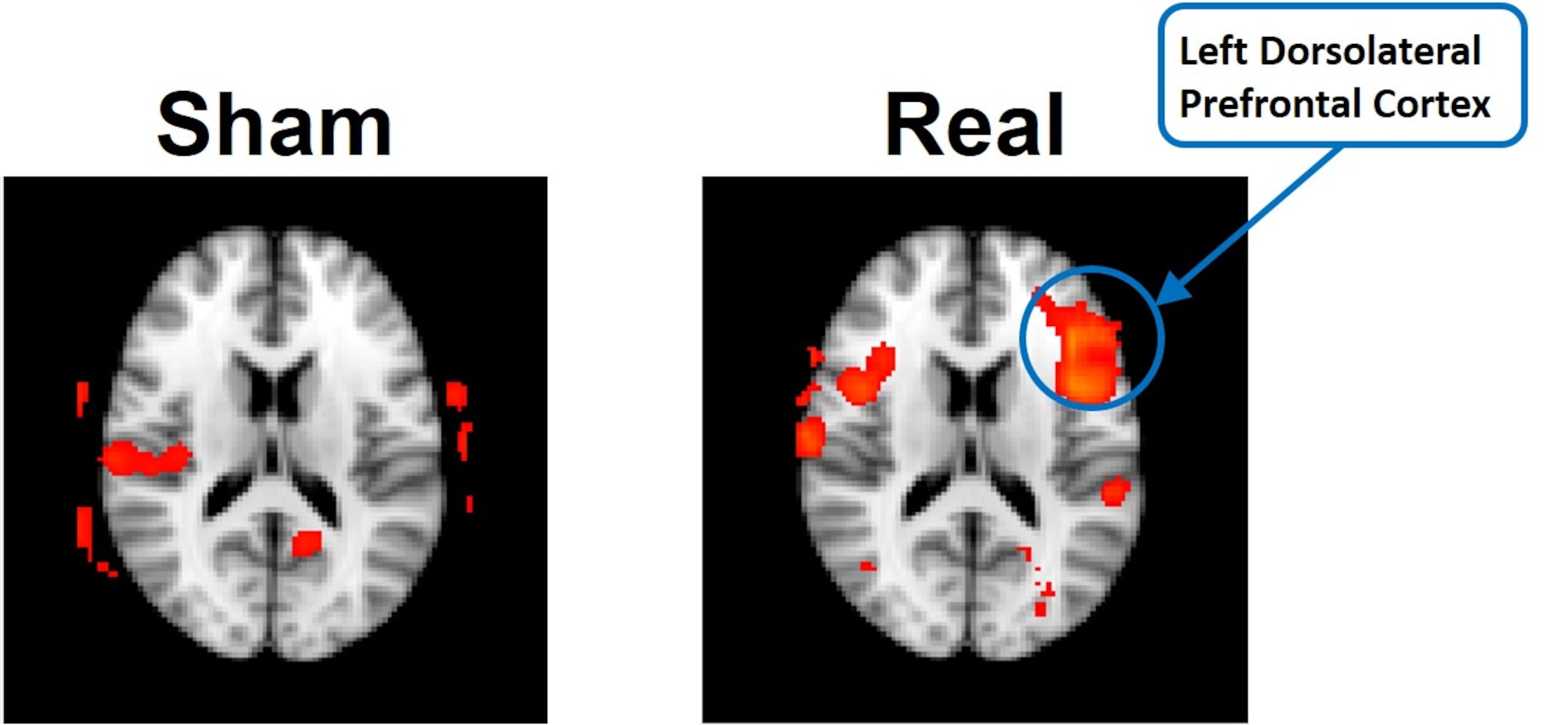 Functional Imaging Scan