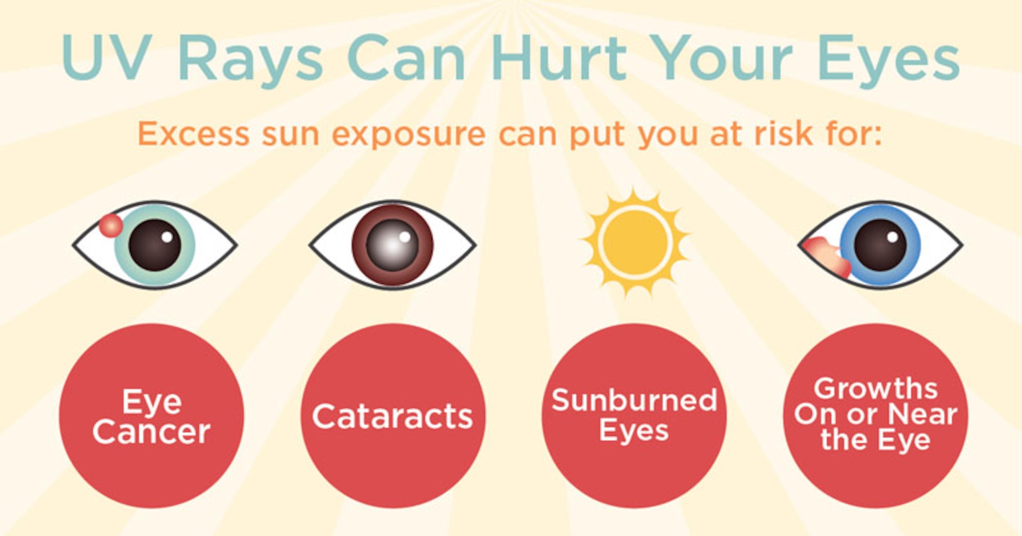 Summer is here and the importance of ultraviolet (UV) protection, especially for our eyes, cannot be overstated. UV-A penetrates easily through the skin. Although it is not as strong as UV-B, it is more prevalent and poses more of a risk to the inner layers of the skin and eyes. UV-B affects the outer layer of our skin and can result in sunburns, blistering, and possibly skin cancer. The front parts of the eye, including the cornea and conjunctiva, are the most affected by UV light. (Courtesy graphic)