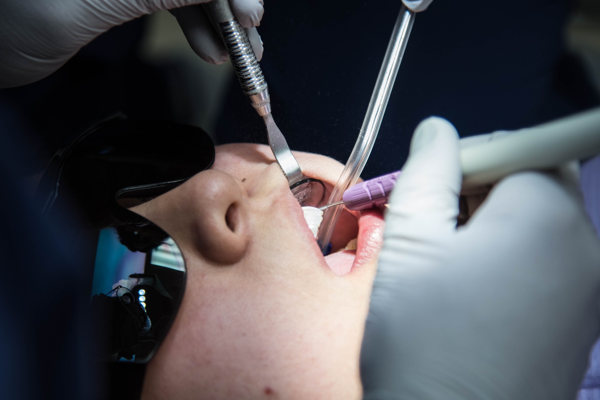 Airman 1st Class Marissa Kruse, 22nd Aircraft Maintenance Squadron crew chief, receives a teeth cleaning Mar. 1st, 2021, at McConnell Air Force Base, Kansas. McConnell dentists and dental assistants preform an average of 40 to 50 dental cleanings in a week for active duty and reserve military members as well as family members. (U.S. Air Force photo by Senior Airman Alexi Bosarge)