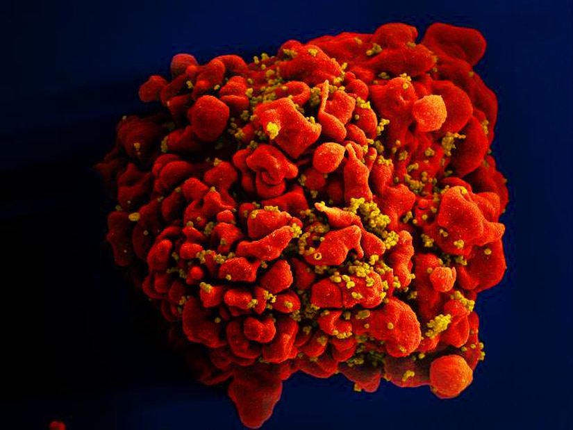 Produced by the National Institute of Allergy and Infectious Diseases (NIAID), this digitally colorized scanning electron microscopic (SEM) image, depicts a single, red-colored, H9-T cell that had been infected by numerous, spheroid shaped, mustard-colored human immunodeficiency virus (HIV) particles, which can be seen attached to the cell's surface membrane.