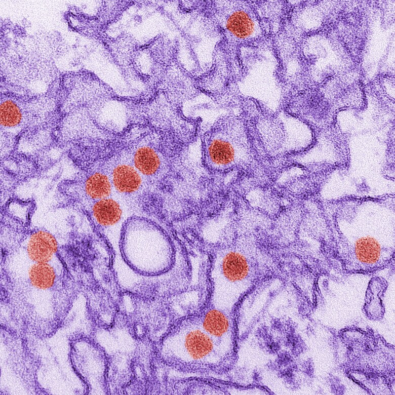 This is a digitally colorized transmission electron microscopic (TEM) image of Zika virus, which is a member of the family, Flaviviridae. Virus particles, here colored red, are 40nm in diameter, with an outer envelope, and an inner dense core.