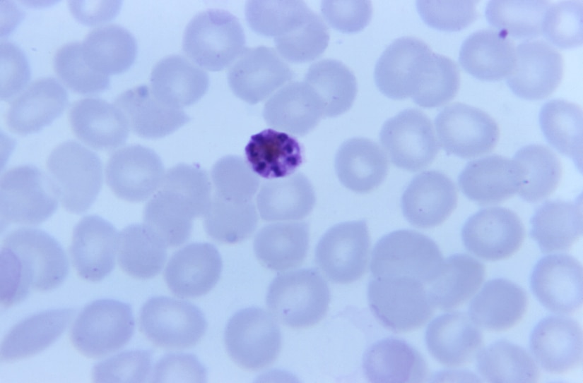 Under a magnification of 1125X, this Giemsa-stained thin film blood smear revealed the presence of a mature, Plasmodium malariae schizont, which contained what appeared to be 8 merozoites arranged in an irregular cluster pattern within its cytoplasm.
