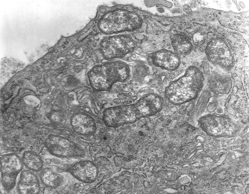 transmission electron microscopic (TEM) image depicted a hypertrophic peritoneal mesothelial cell of mouse that had been experimentally infected with Orientia tsutsugamushi rickettsial micro-organisms. In this view, there were several organisms visible free within the mesothelial cell's cytoplasm. Formerly known as Rickettsia tsutsugamushi, O. tsutsugamushi is the pathogen responsible for causing the febrile disease known as scrub typhus. The disease is transmitted to humans through the bite of larval trombiculid mites, i.e., chiggers, that had fed on infected rodents.