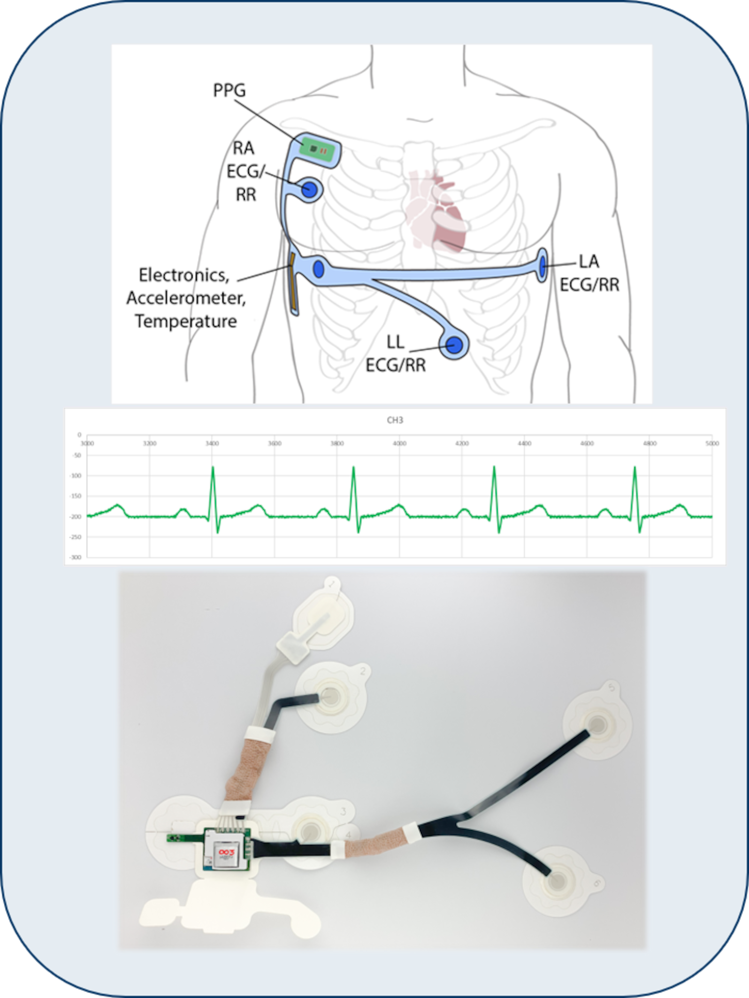 The Nano-Bio Materials Consortium provides the means for industry—now with AFRL personnel working alongside—to develop smart medical technology innovations that benefit the Air Force mission and the greater world, such as this low-cost, wireless, vital sign monitor developed with flexible hybrid electronics and adapted for USAF En Route Care patient monitoring. (Photo courtesy of GE Research and the Nano-Bio Materials Consortium)