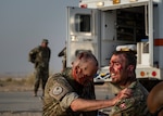 Person puts on moulage on a simulated casualty.