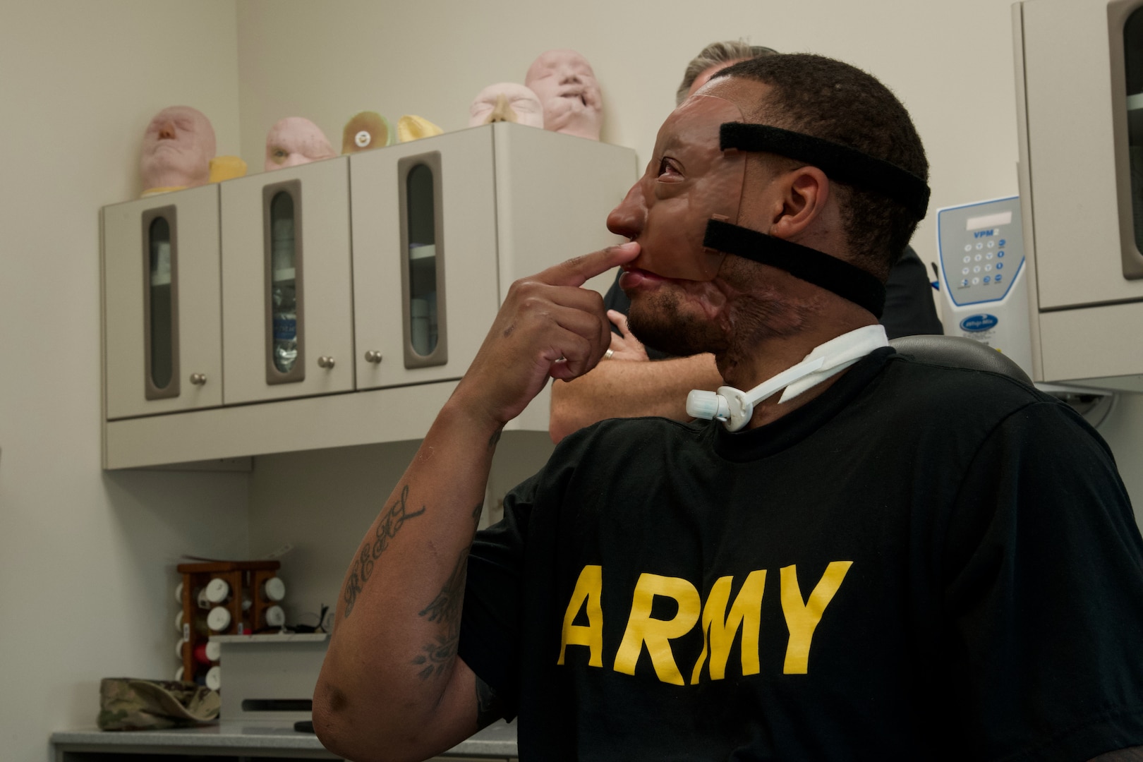 patient speaks with care team about prosthetic mask