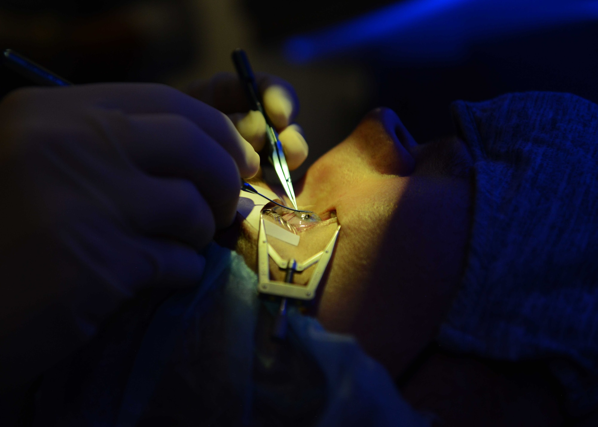 Staff Sgt. Zachary Martini, ophthalmology patient, undergoes a small incisional lenticular extraction (SMILE) eye surgery at the 10th Medical Group, Air Force Academy, Colo., Aug. 19, 2021.