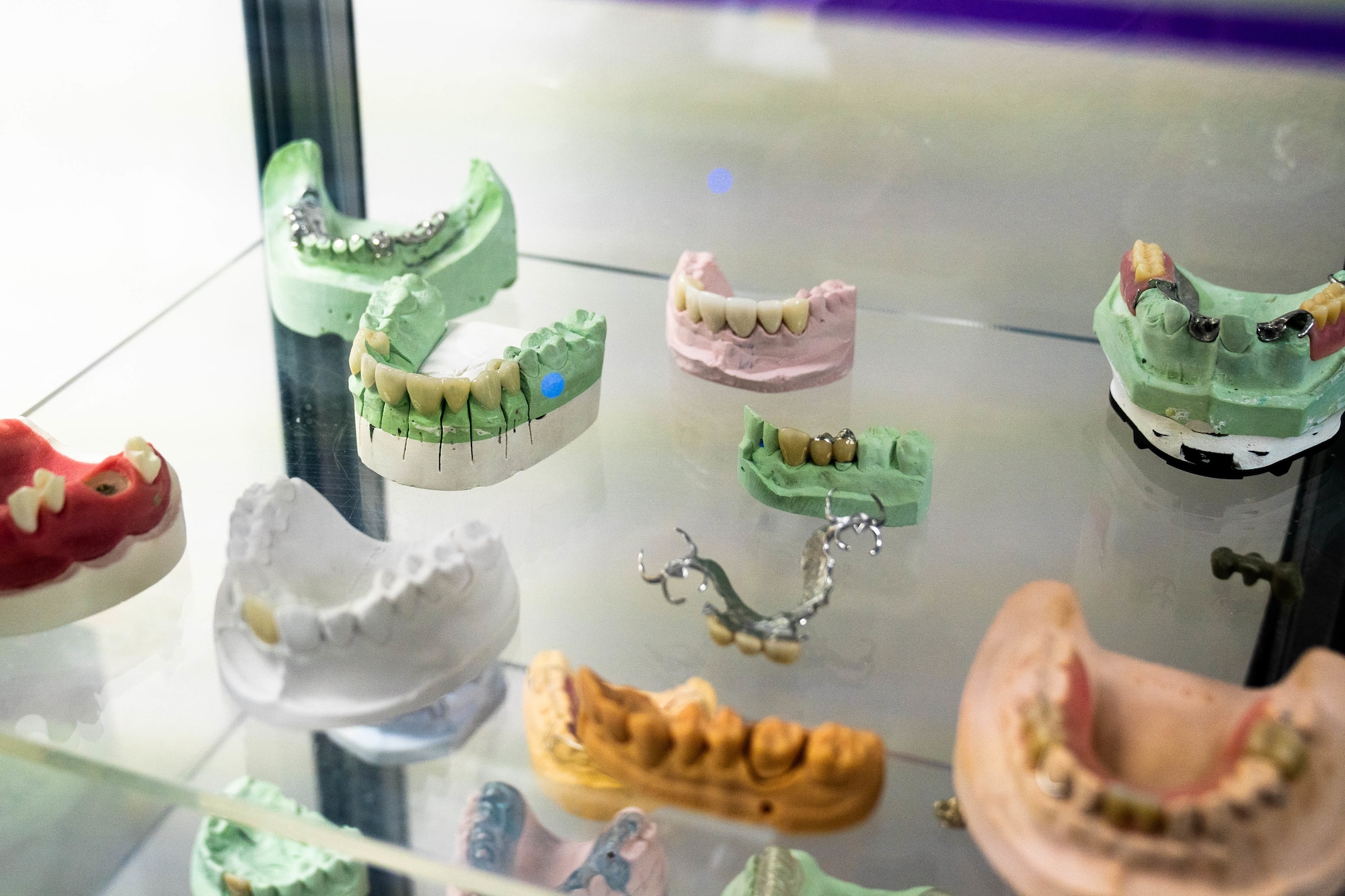 A display of model impressions and retainers sits in the dental lab at Joint Base Pearl Harbor-Hickam, Hawaii, April 5, 2022. Dental technicians take impressions of the patient’s mouth to design and 3D print crowns, retainers, night guards and other forms of dental gear. (U.S. Air Force photo by Airman 1st Class Makensie Cooper)