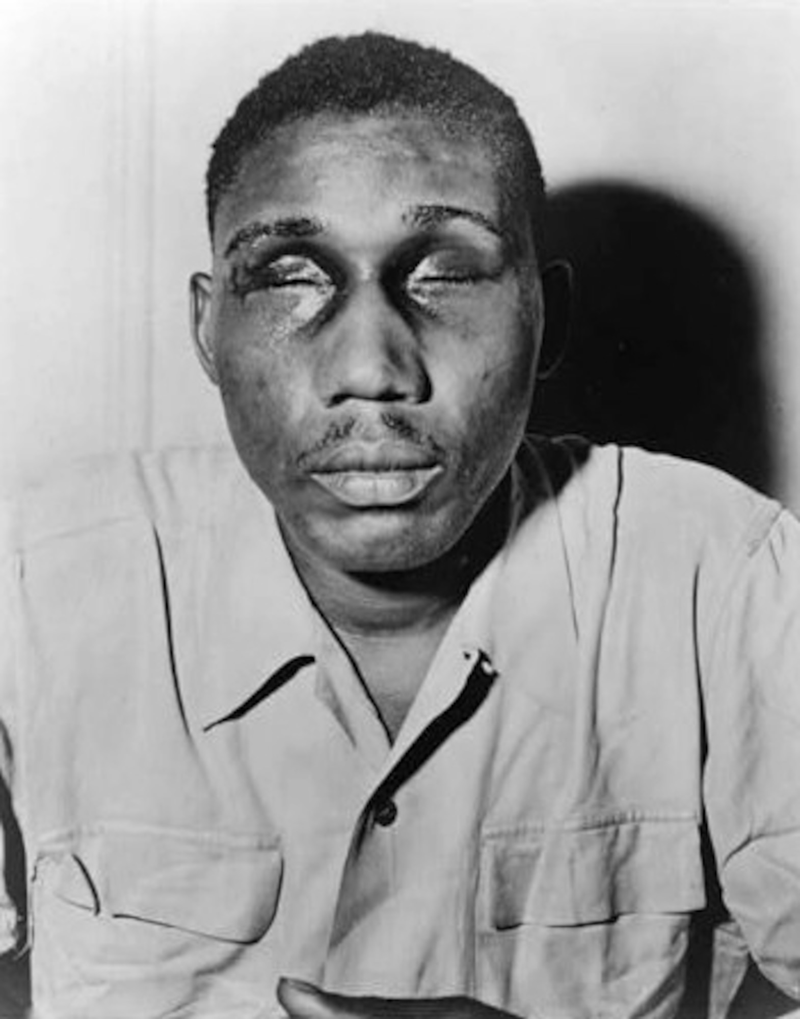 Sergeant Isaac Woodard, Jr. was returning home after receiving an honorable discharge. He was a decorated war veteran and was still wearing his service uniform when the police chief drove a nightstick into his eyes
