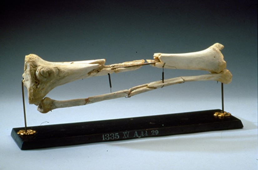 A human leg bone sits on display.