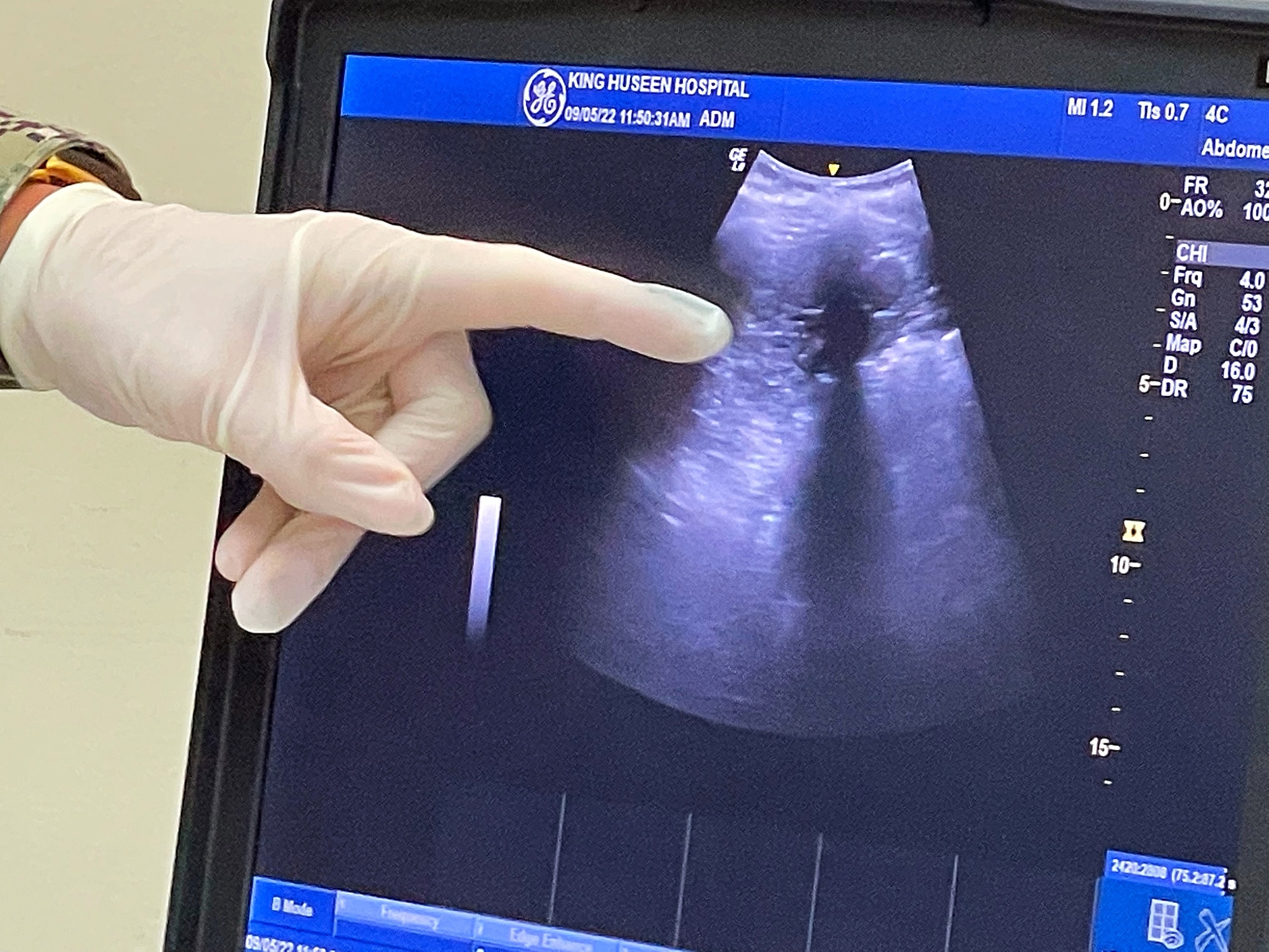 Lt. Cmdr. Taylor DesRosiers, Walter Reed Medical Center critical care fellow, points to a structure on an ultrasound machine screen while providing a demonstration of various techniques inside the King Hussein Medical Center May 9, 2022 in Amman, Jordan.