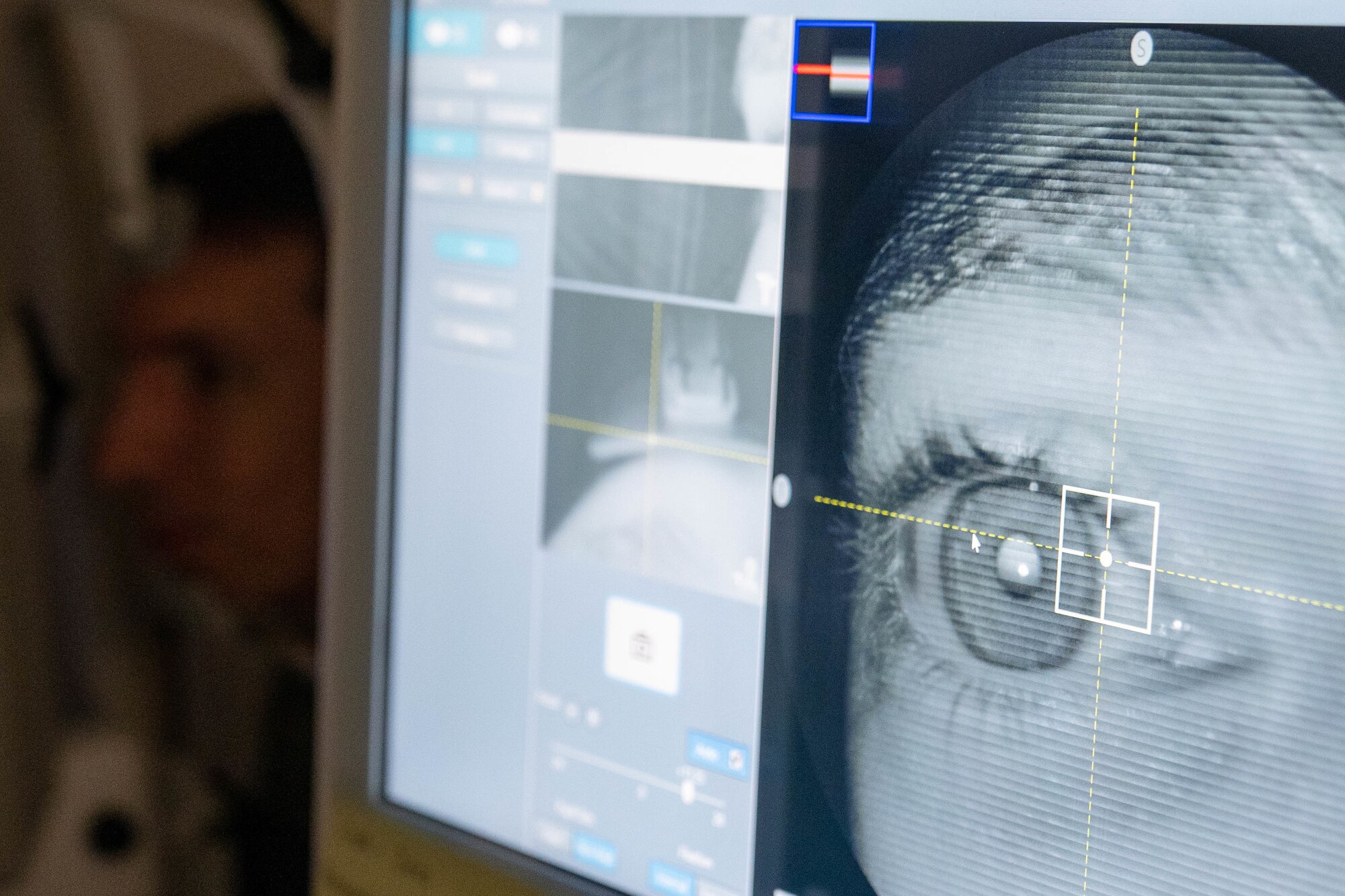 Capt. Dominic Rentz, 15th Operational Medical Readiness Squadron optometrist, demonstrates the new retinal camera at the optometry clinic at Joint Base Pearl Harbor-Hickam, Hawaii, June  16, 2022. Optometry technicians aid in the diagnosis of eye disorders while also playing an integral part in helping patients with their eye health. (U.S. Air Force photo by Airman 1st Class Makensie Cooper)