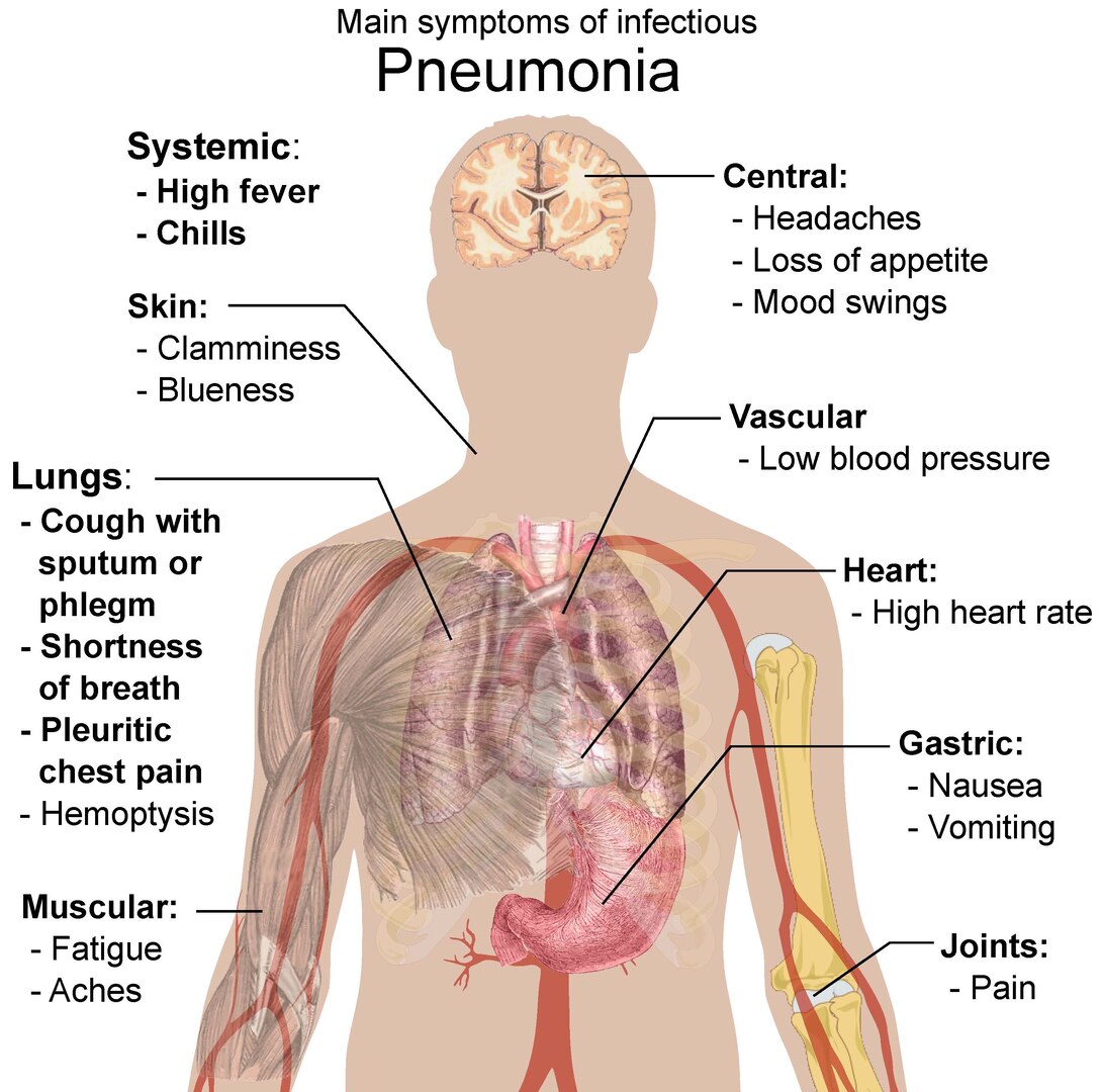 World Pneumonia Day Focuses On Awareness Prevention Walter Reed 