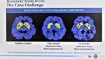Dr. Dominick DePhilippis, a clinical psychologist who serves as the VA deputy national mental health director for the U.S. Department of Veterans Affairs (VA) in New Jersey, used brain scans to explain the time challenge in recovery from substance use disorder, during the Sixth Annual Substance Use Disorder (SUD) Symposium, hosted by the National Capital Region Pain Initiative (NCRPI) at Walter Reed National Military Medical Center, Sept. 21.