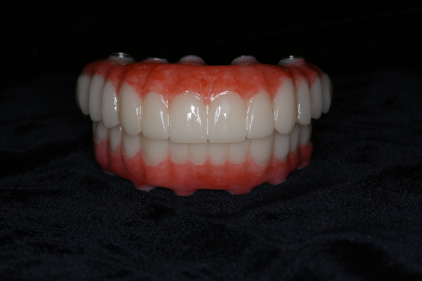 A file photo of full-arch 3D-printed teeth, similar to the ones that were implanted by Navy dentists in the two patients that underwent the “all-on-4” procedure at Naval Hospital Bremerton, Washington in April, 2022. The white part of the teeth are 3D printed, and the pink part is a hand-layered composite. (Courtesy photo/U.S. Navy)