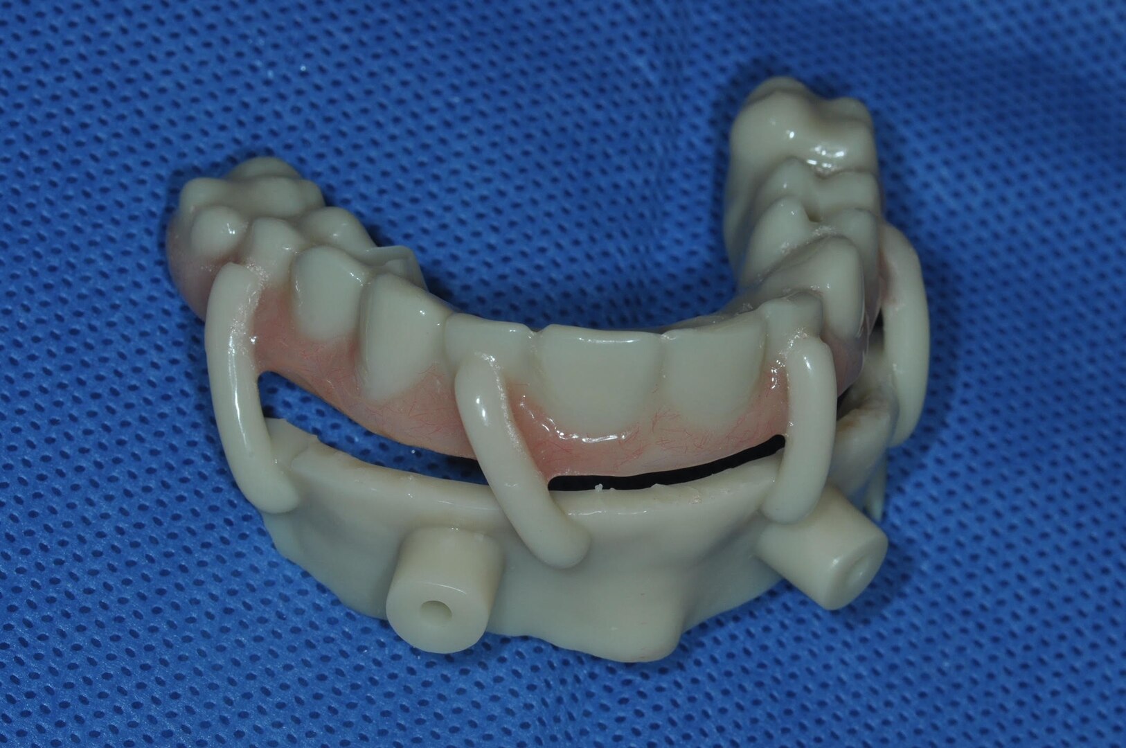 The actual 3D-printed teeth that were implanted by Navy dentists in one of the two patients that underwent the “all-on-4” procedure at Naval Hospital Bremerton, Washington in April, 2022. (Courtesy photo/U.S. Navy)