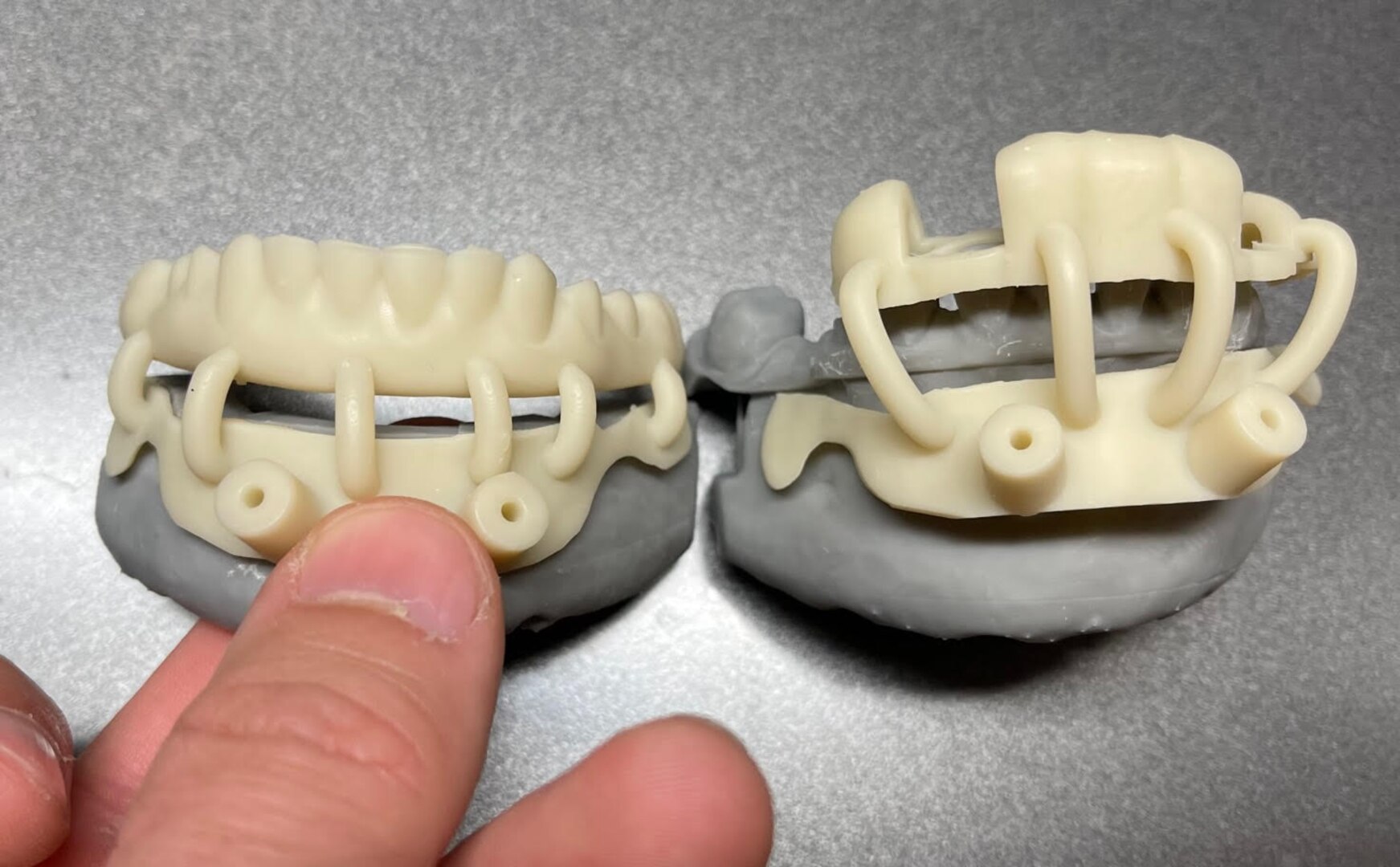 The actual 3D-printed teeth that were implanted by Navy dentists in one of the two patients that underwent the “all-on-4” procedure at Naval Hospital Bremerton, Washington in April, 2022. (Courtesy photo/U.S. Navy)