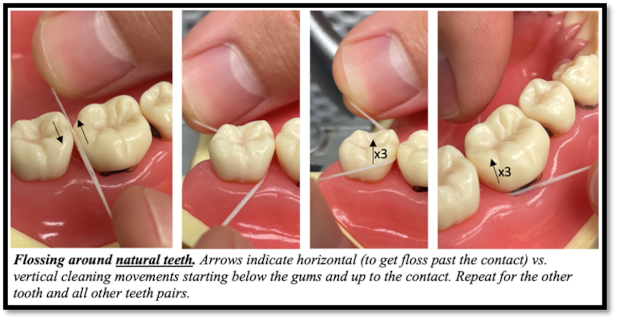 Is flossing that important? > Wright-Patterson AFB > Article Display