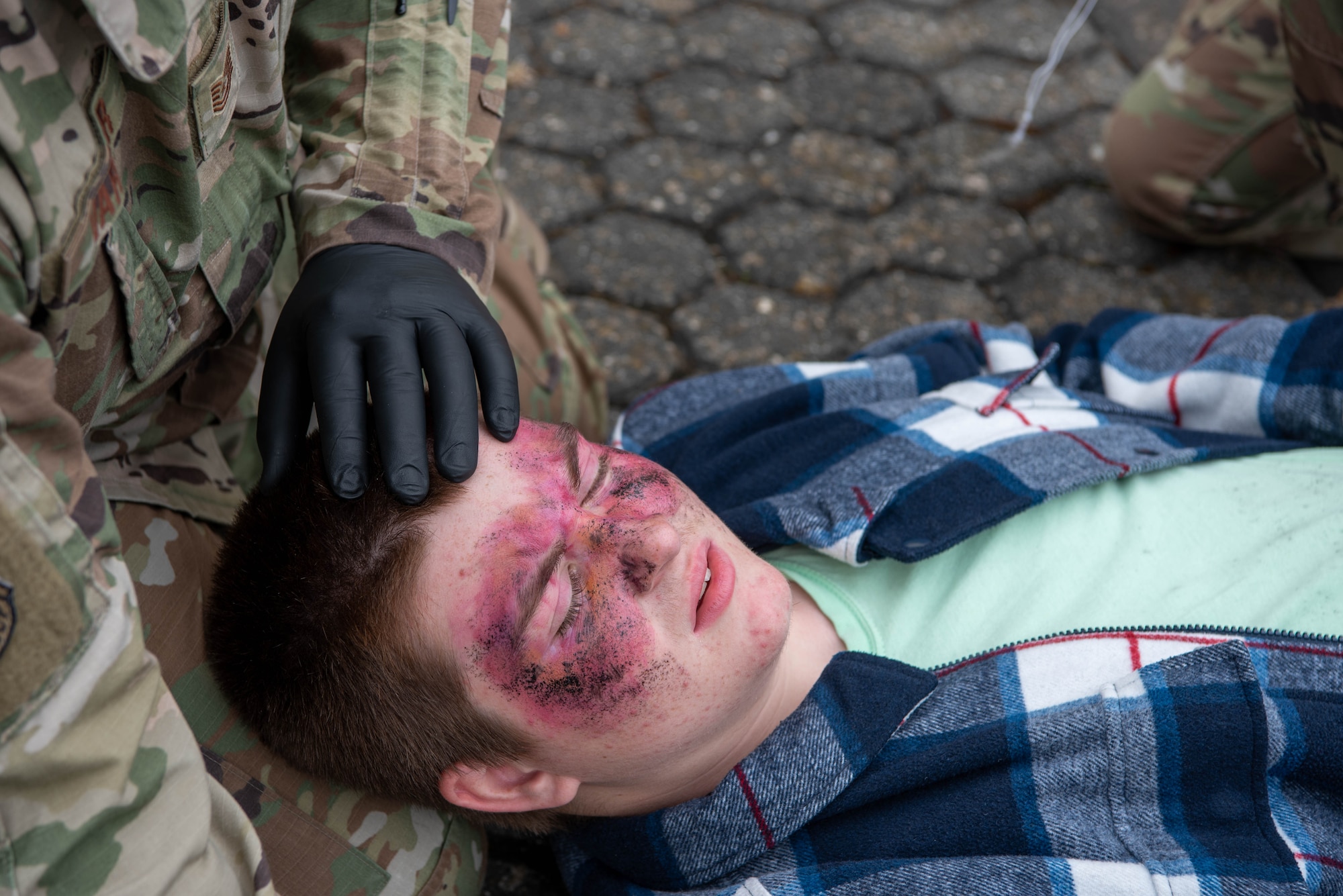 A child in moulage.