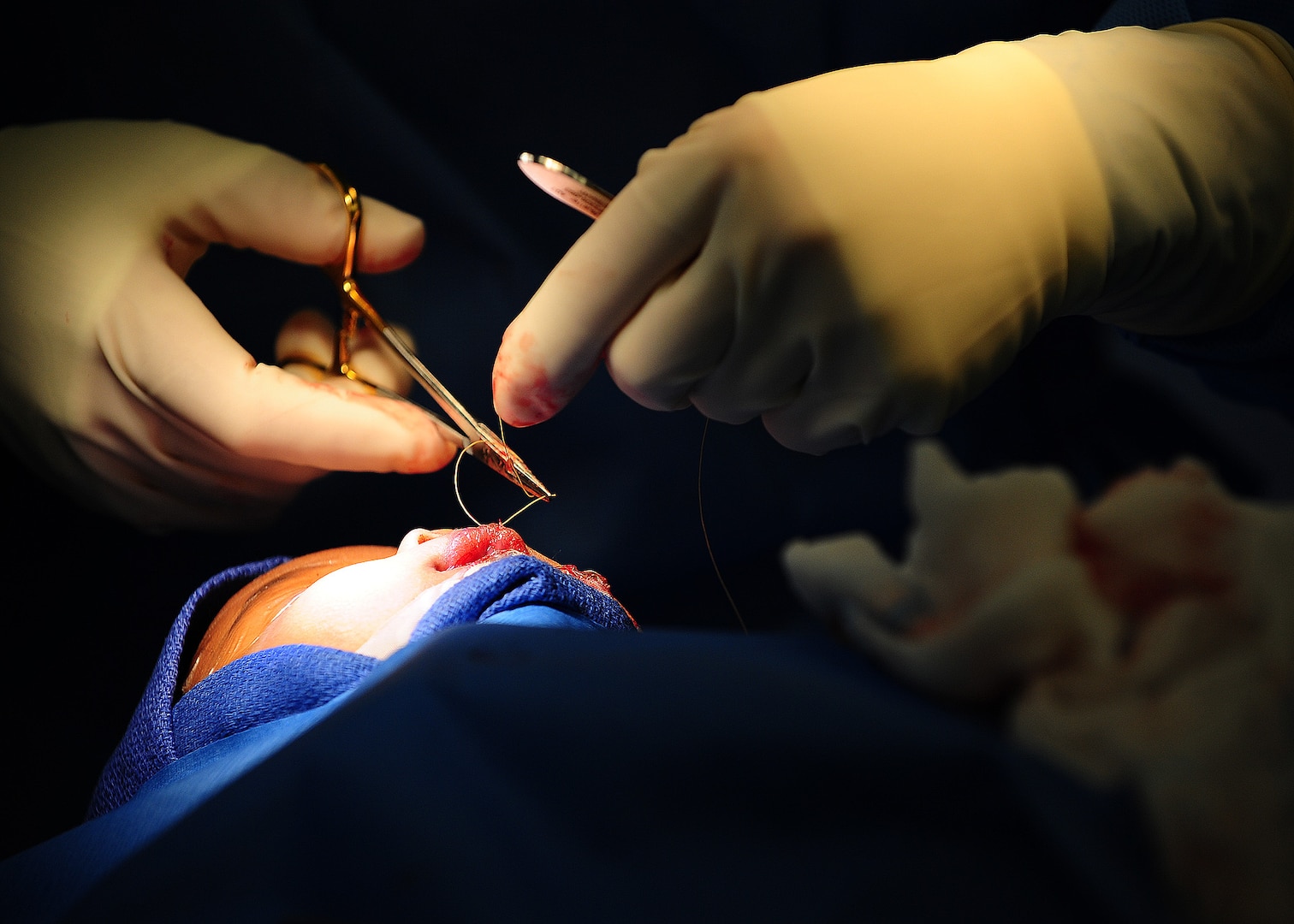 U.S. Air Force Lt. Col. Kerry Latham, a plastic surgeon with the Walter Reed Army Medical Center, cuts a surgical suture while conducting cleft lip surgery on a 3-month-old Belizean girl during a surgery medical readiness training exercise as part of New Horizons 2013 April 30, 2013, at Northern Regional Hospital in Orange Walk, Belize. New Horizons is a U.S. Southern Command-sponsored annual series of joint humanitarian assistance exercises deploying U.S. military engineers, veterinarians, medics and other professions to Central and South American nations for training, construction projects and to provide humanitarian and medical services.